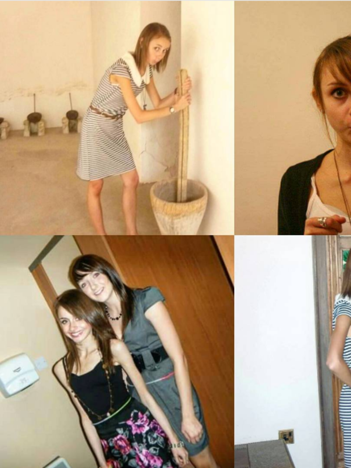 Fiona na zdjęciach, kiedy borykała się z anoreksją
