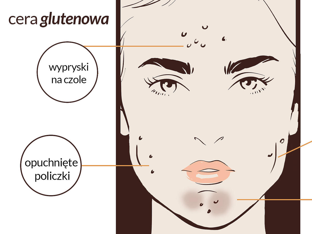 Wpływ glutenu na stan cery