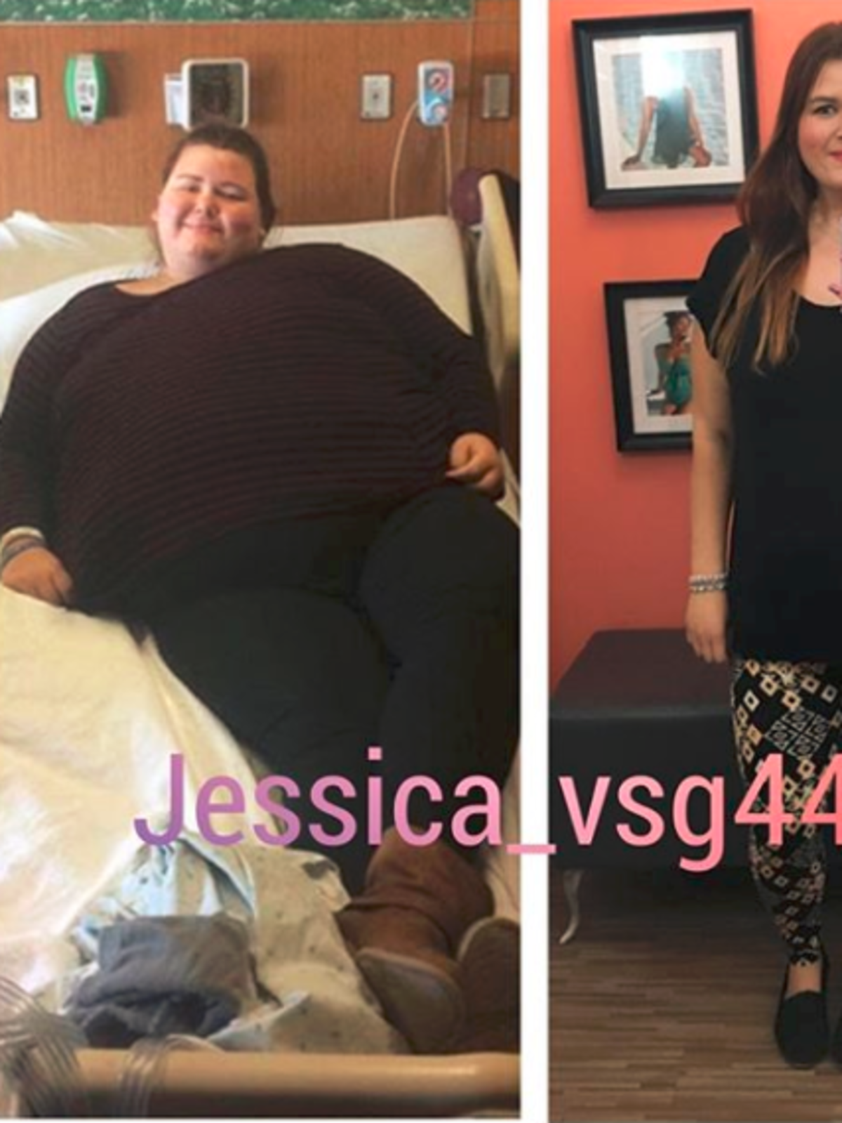 Ta dziewczyna schudła ok. 80 kg i pokazuje fałdy skóry, które pozostały
