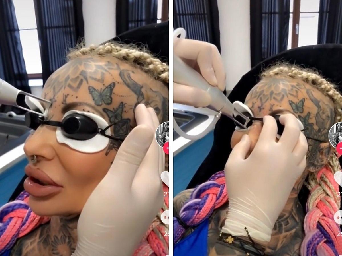 Ada z Królowych życia usuwa sobie tatuaż z nosa w studio