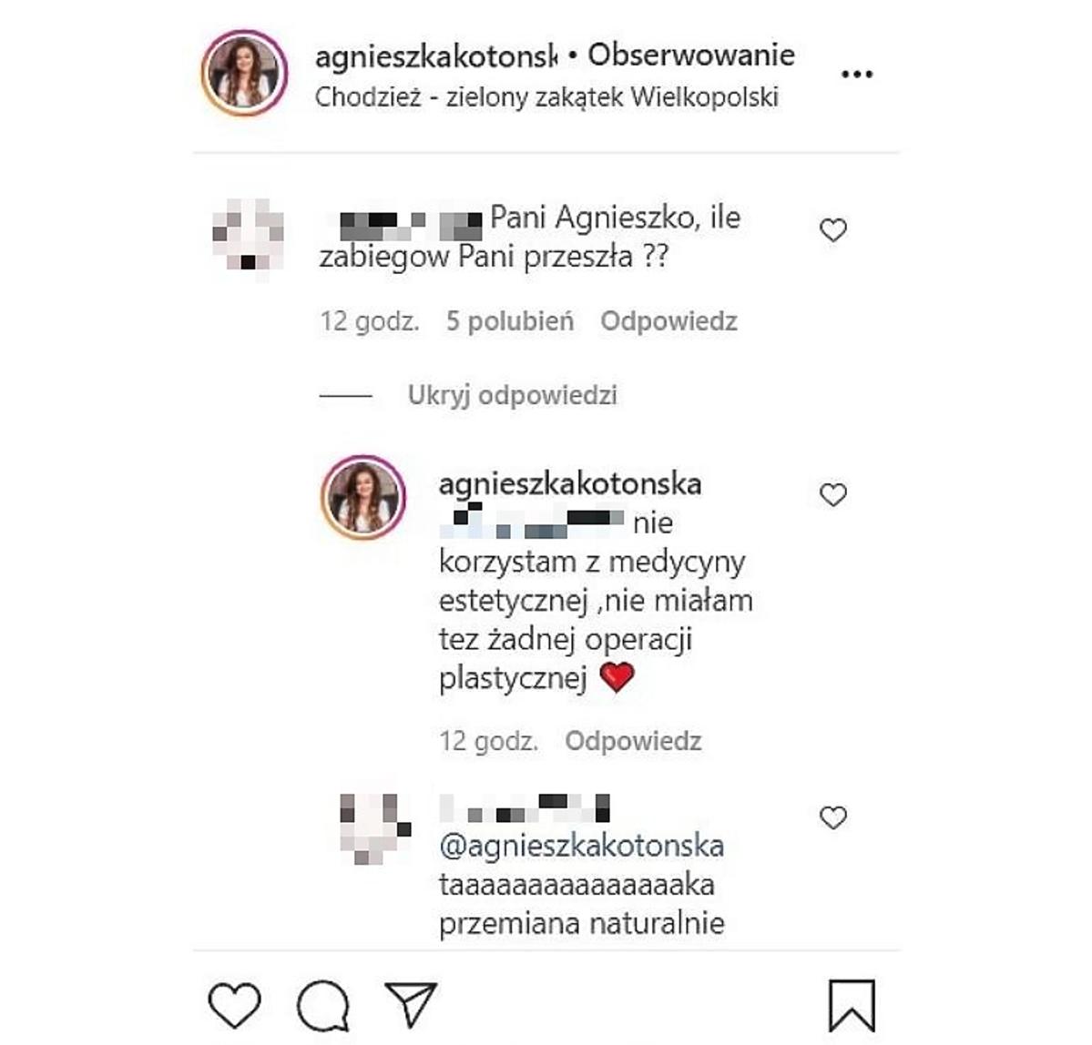 Agnieszka Kotońska odpowiada na komentarz internauty