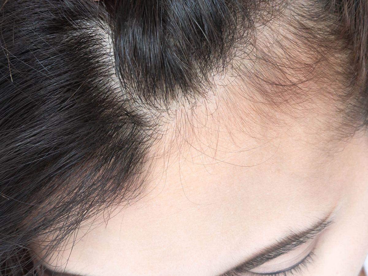 Domowa wcierka do włosów z rozmarynu powoduje wysyp baby hair