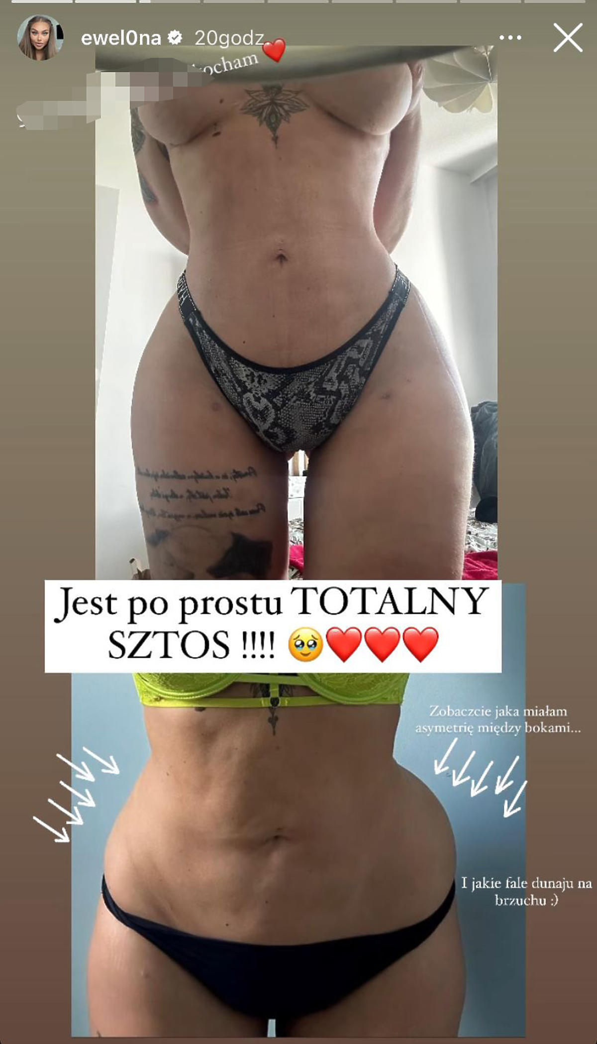 Ewel0na z Warsaw Shore pokazała brzuch po liposukcji 