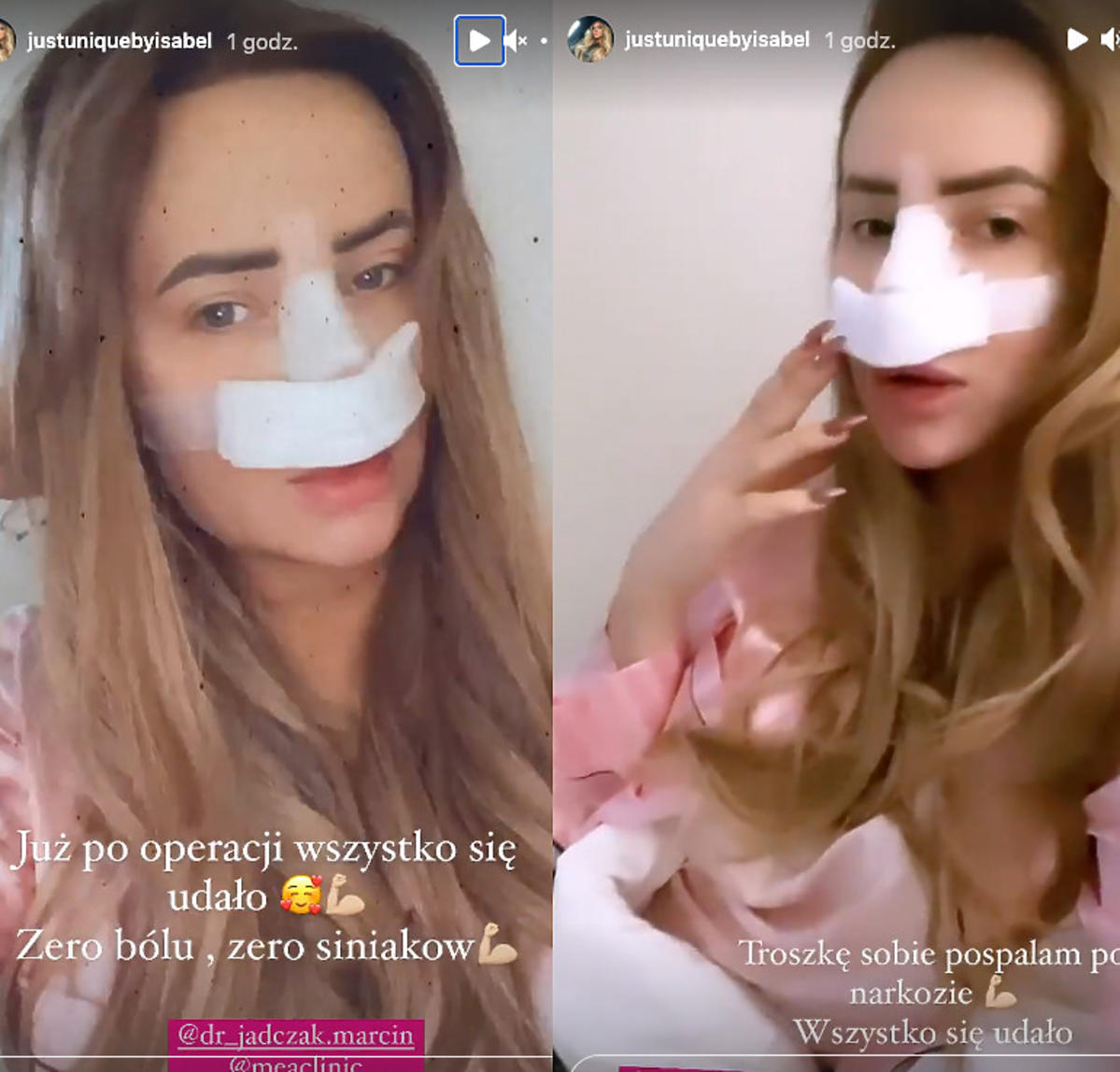 Izabele Macudzińska po operacji z opatrunkiem na nosie