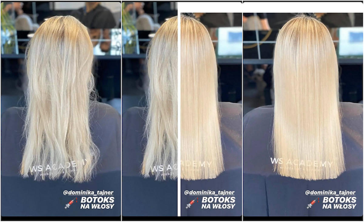 Jak Dominika Tajner wygląda po botoksie na włosy?