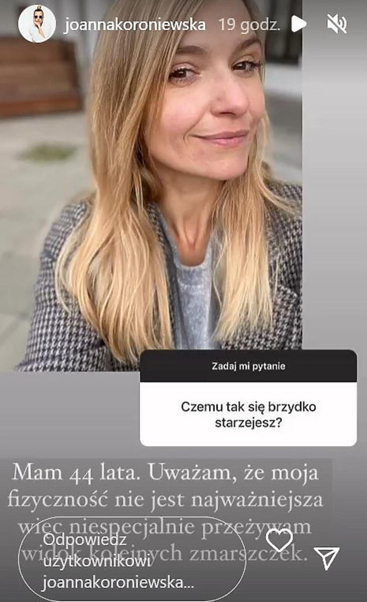Joanna Koroniewska szczerze o swoim wyglądzie