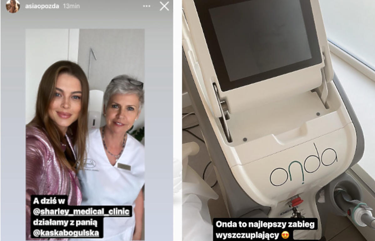 Joanna Opozda - zabieg wyszczuplający po ciąży - Onda