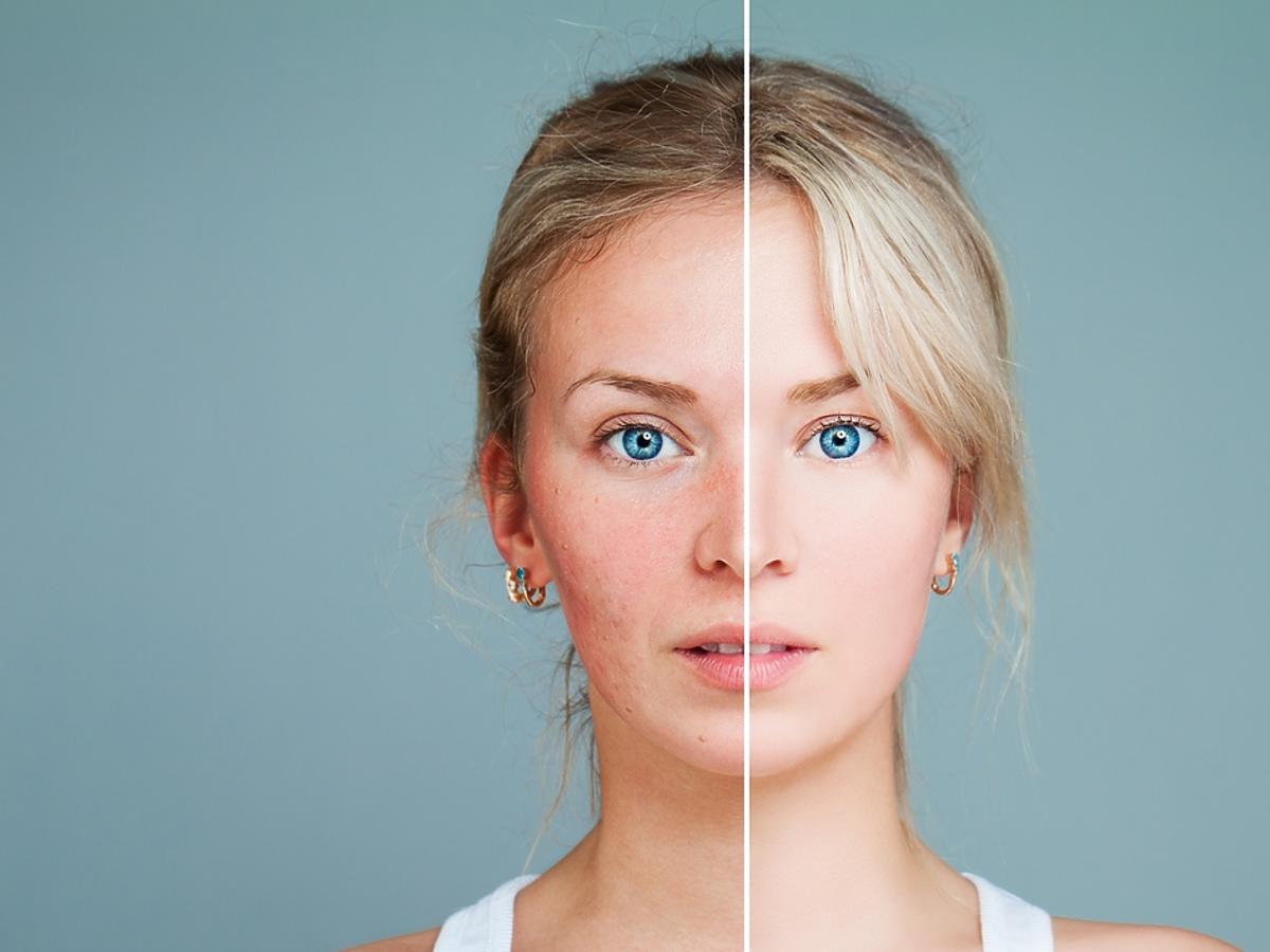 kobieta przed i po metamorfozie twarzy