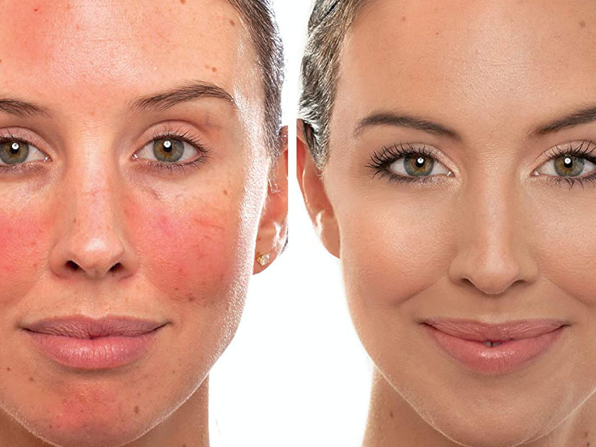 krem korygujący zaczerwienienia na twarzy - efekt po zastosowaniu IT Cosmetics