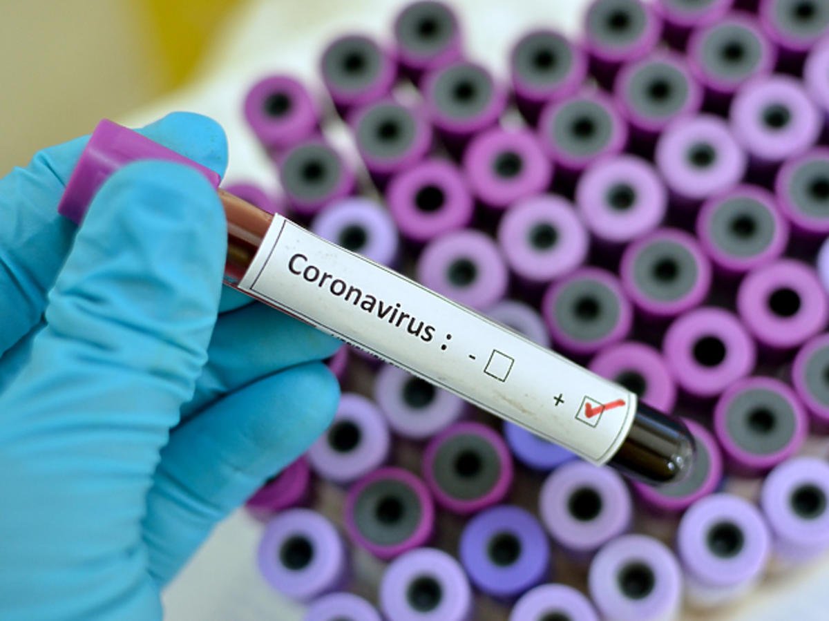 Krzepliwość krwi a koronawirus