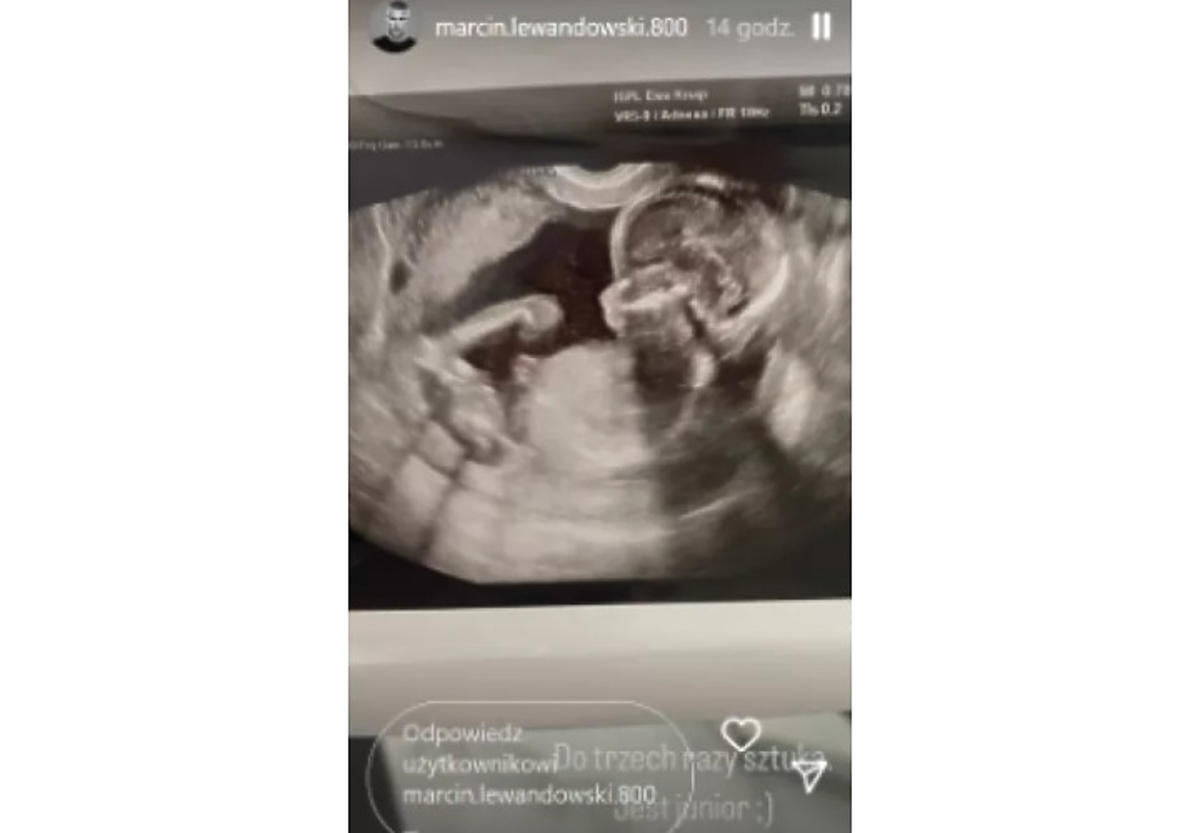 Lewandowski pokazał zdjęcie USG syna
