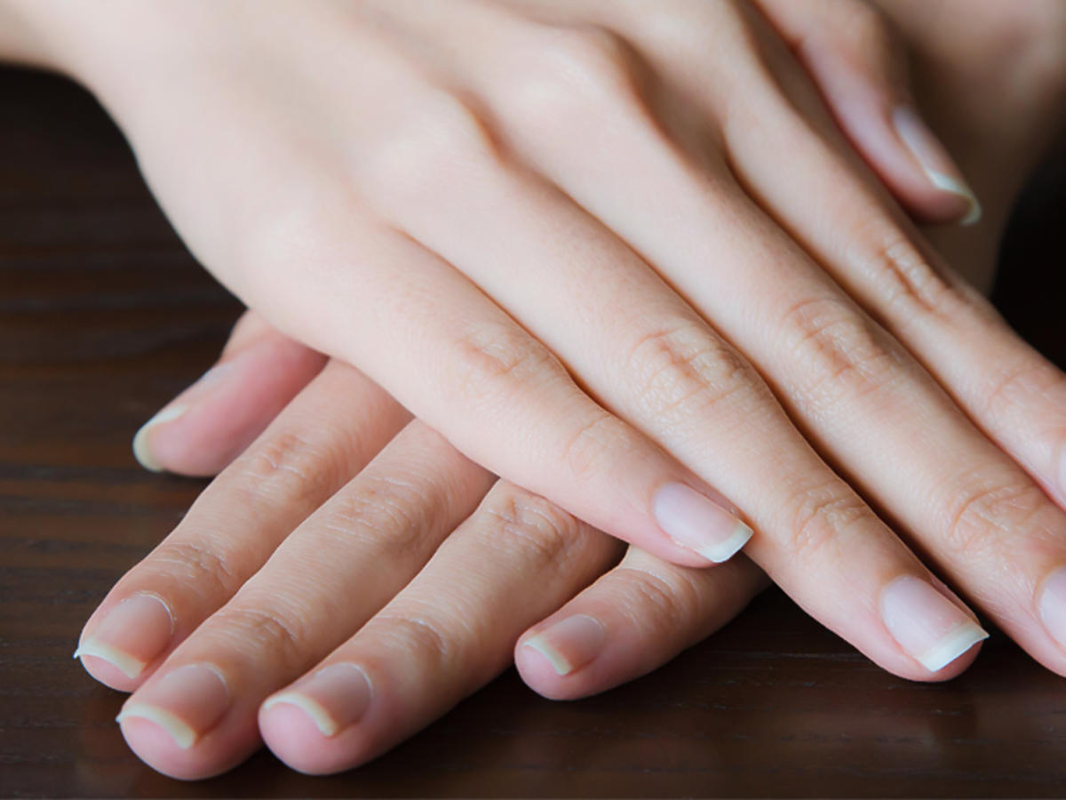 łuszczyca paznokci przyczyny objawy leczenie manicure hybrydowy lakier do paznokci
