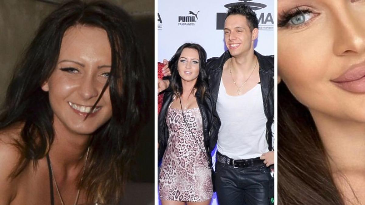 Dlaczego Mala Ania Odeszła Z Warsaw Shore "Warsaw Shore": Tak zmieniła się Mała Ania! Uszy, żuchwa, zęby i