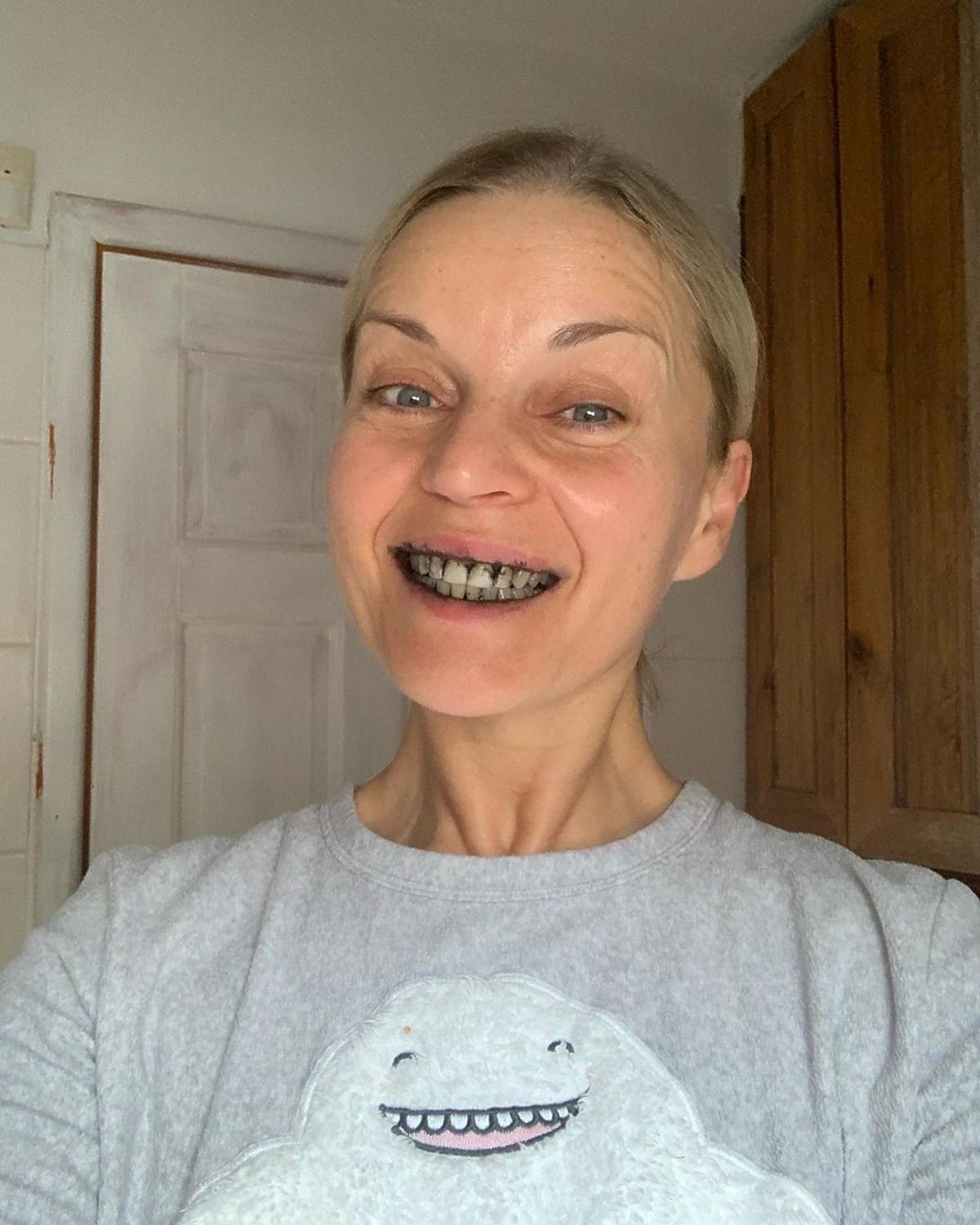 Małgorzata Foremniak bez makijażu i z czarnymi zębami