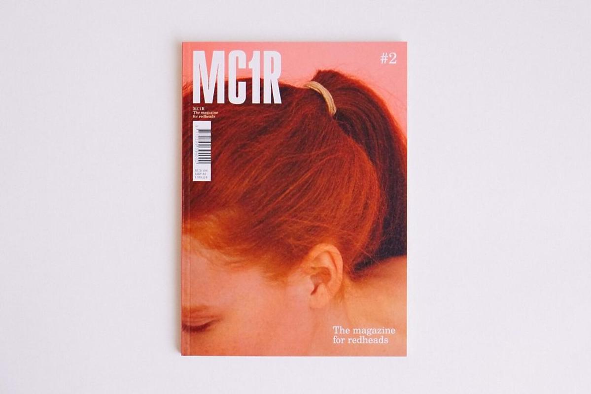 MC1R magazyn
