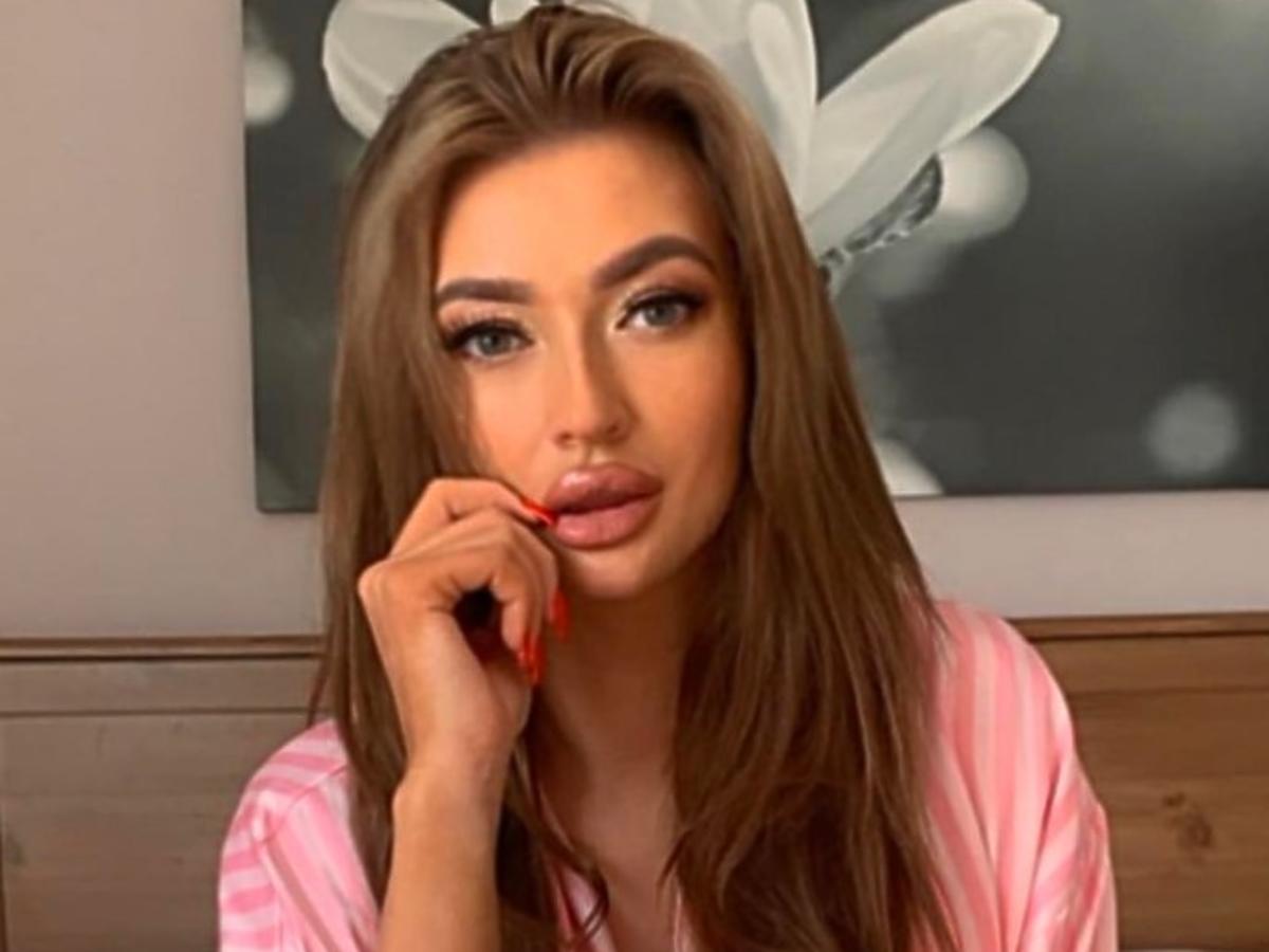 Natalia Lieber z „Love Island” znowu powiększyła usta