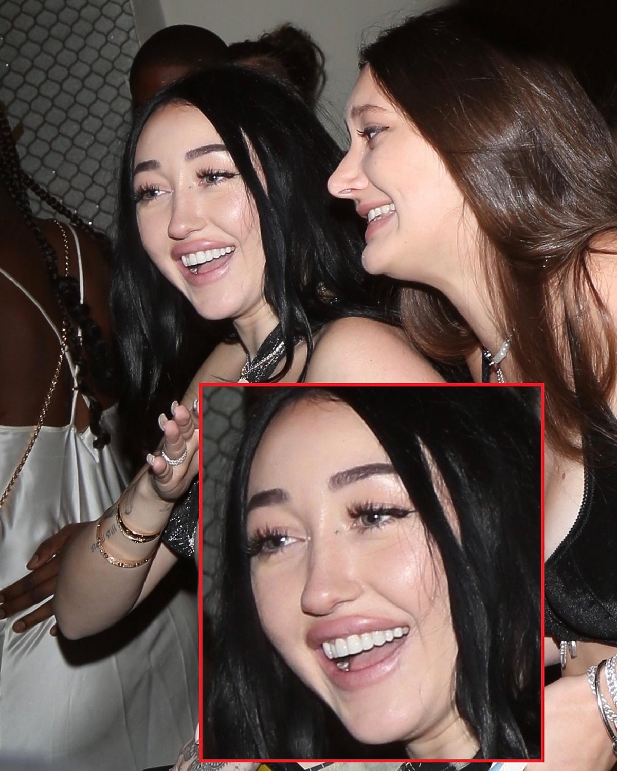 Noah Cyrus przesadziła z powiększaniem ust