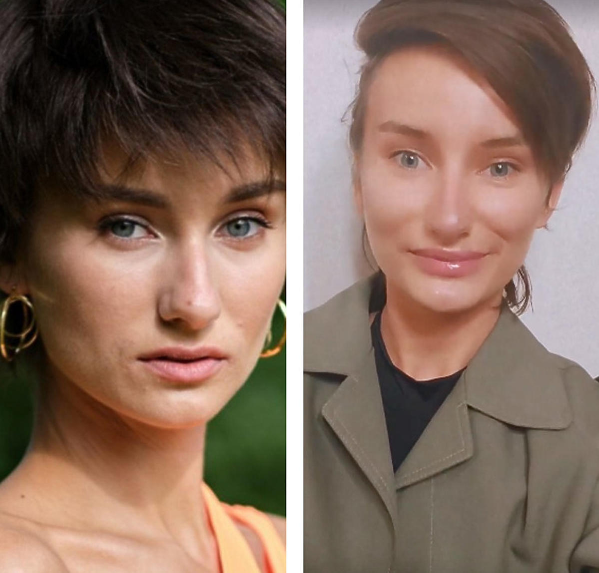 Olga Król z Top Model przed i po powiększeniu ust