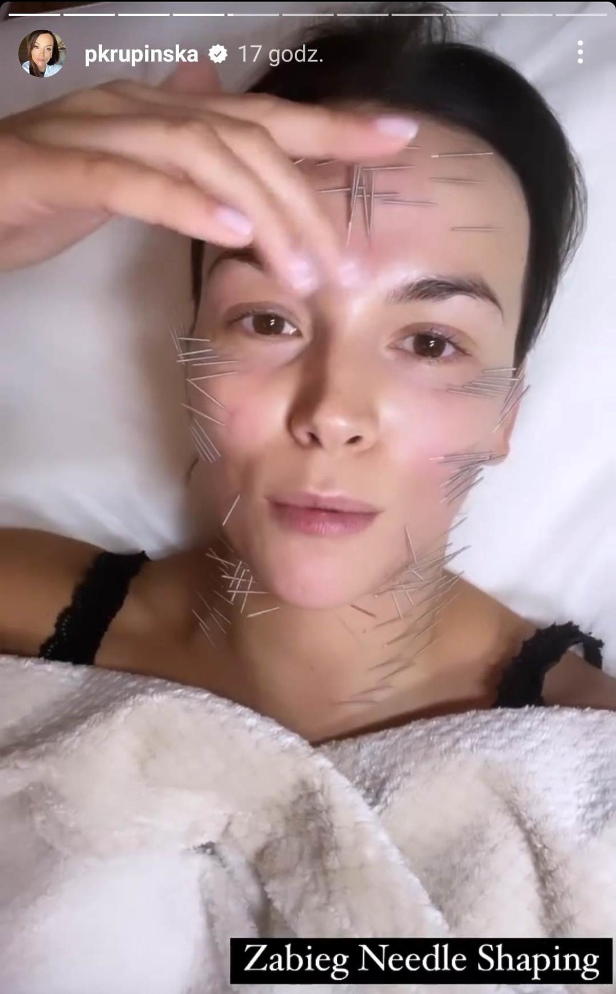Paulina Krupińska opublikowała nagranie z igłami wbitymi w twarz