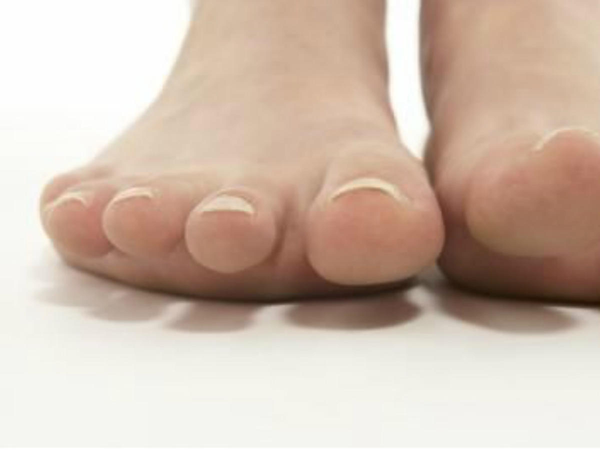 pozolke paznokcie u stop powstrzymuja cie przed noszeniem sandalkow znamy domowy patent na ten problem klejnoty do paznokci swarovski stylizacja wiosna 2021