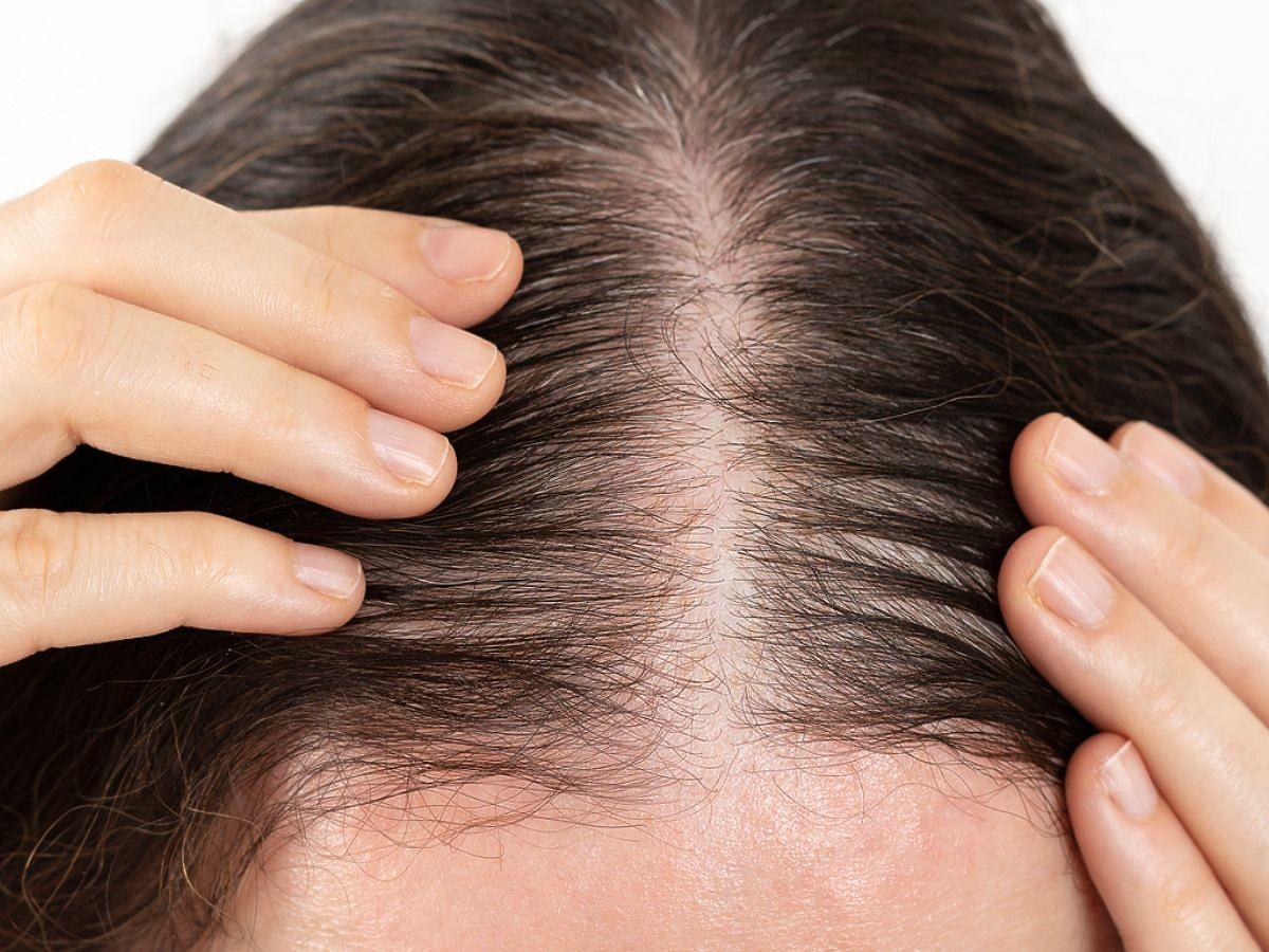 serum do skóry głowy na porost włosów