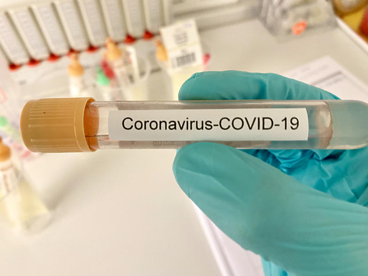 Testy na koronawirusa