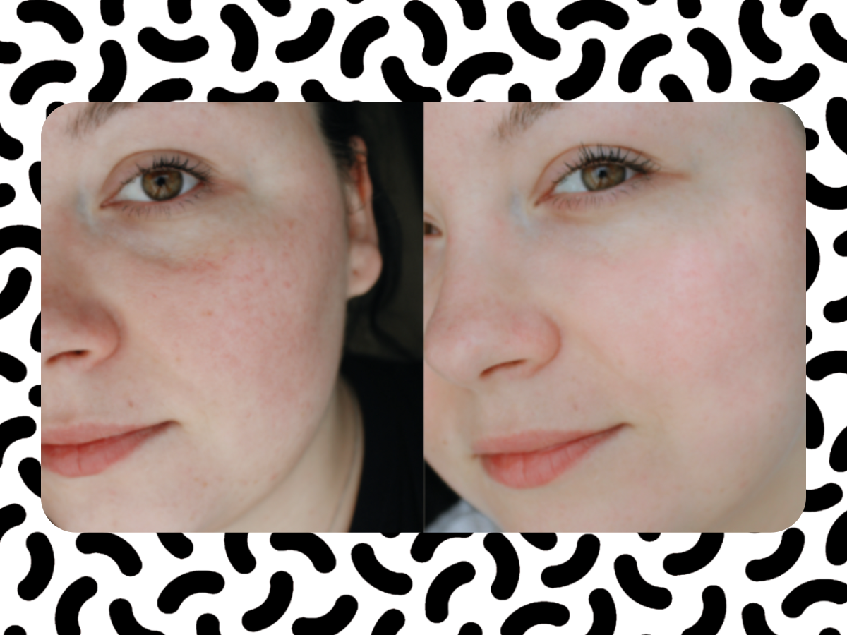 twarz przed i po zastosowaniu efekty stosowania krem na dzień Mixa, Niacinamide Glow