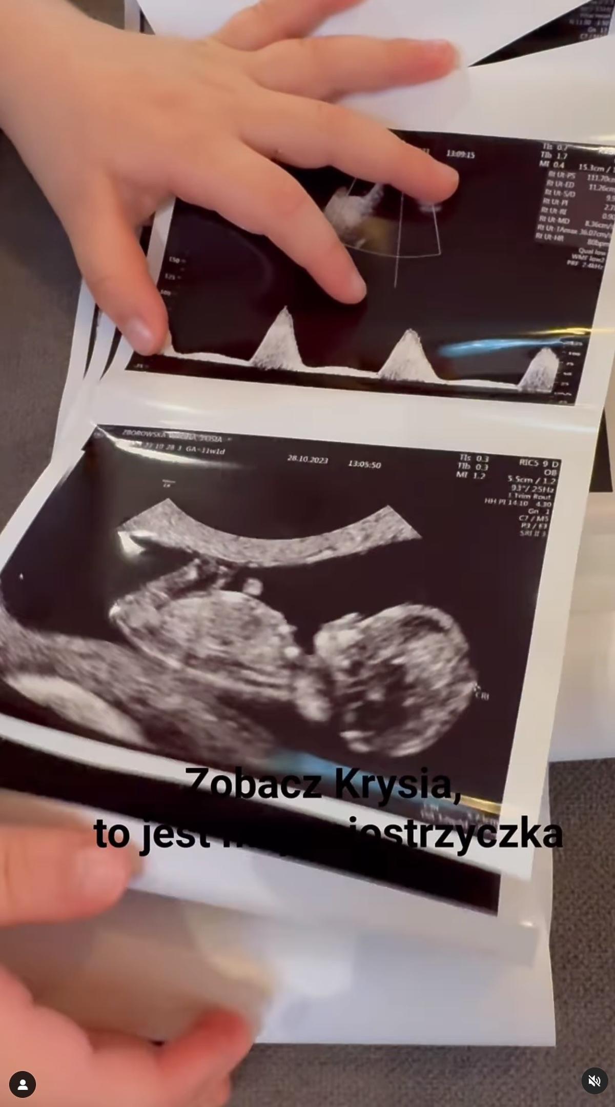 Zofia Zborowska jest w drugiej ciąży